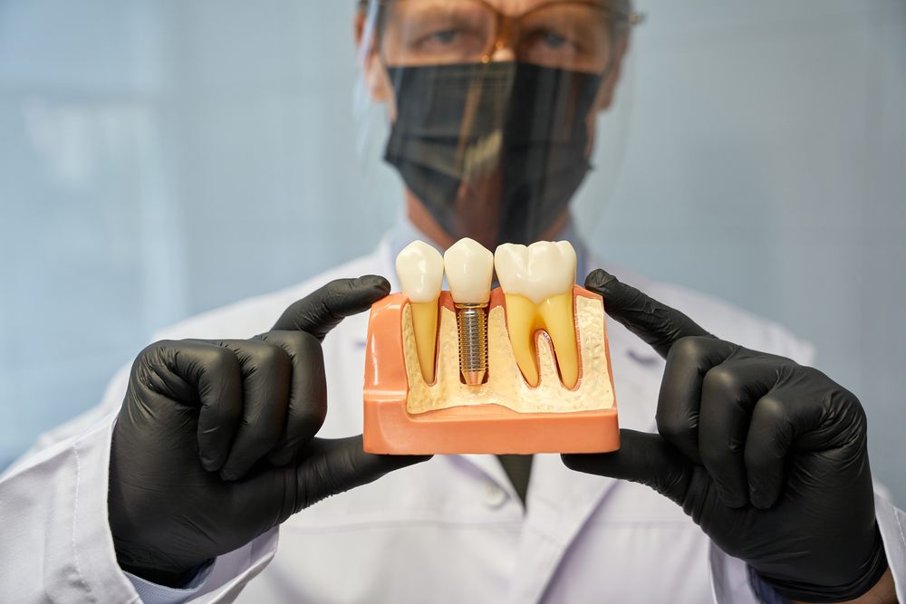 Serious dentist showing a teeth model with implant to camera
