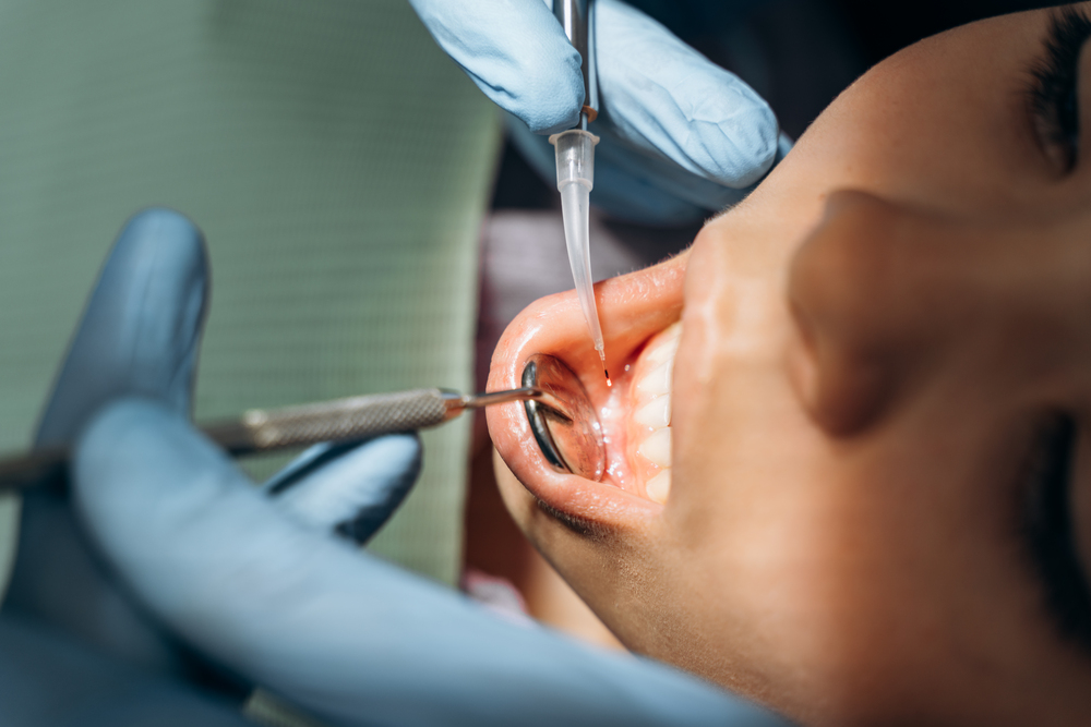 Dentist examining dental gums