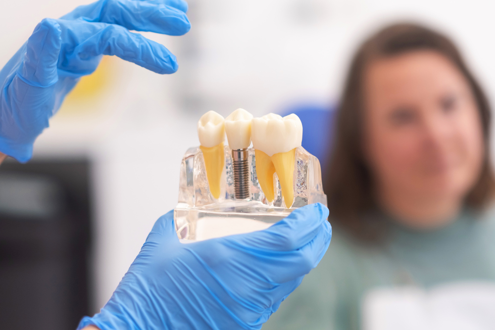 Close-up of dental model with implant. patient of dental clinic on blurred background. dentistry Dentistry patient being sedated with N2O gas