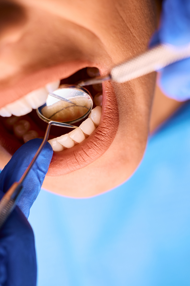 Dentist examining after putting dental crowns in North York